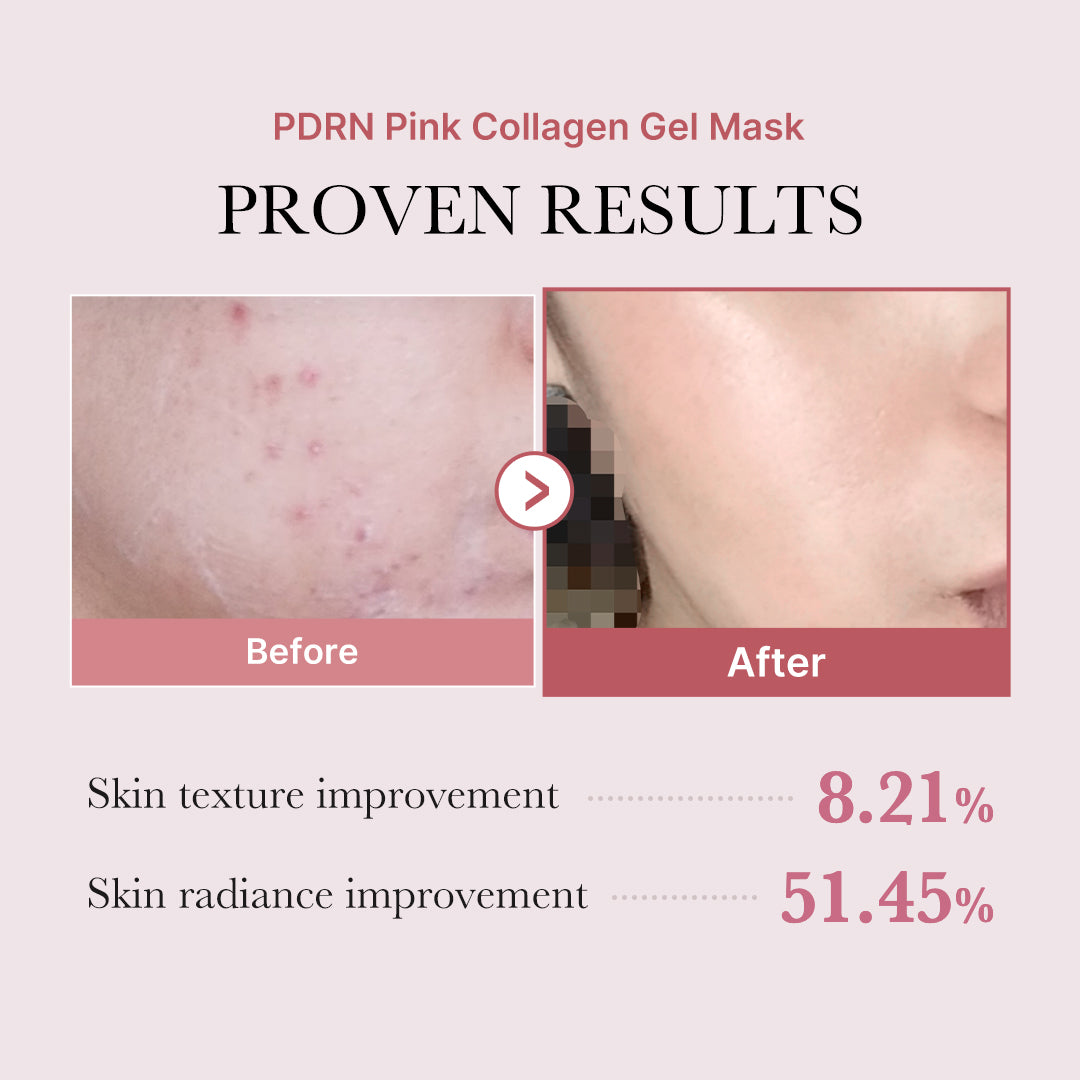 MEDICUBE Máscara em Gel de Colágeno de Salmão PDRN Pink