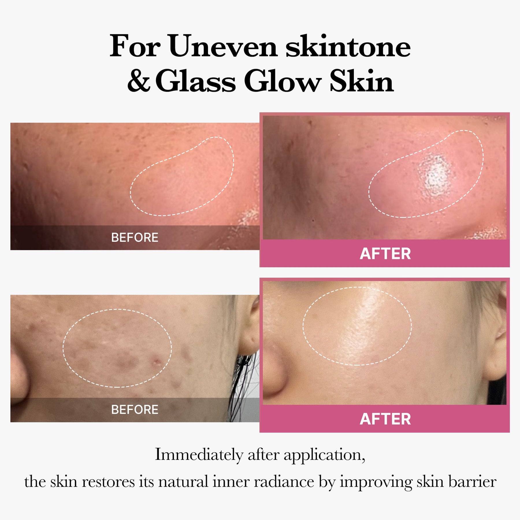 MEDICUBE [Tati's Exclusive] Plump Perfection Set